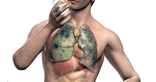 سرطان الرئة ليس مرتبطا آليا بالتدخين