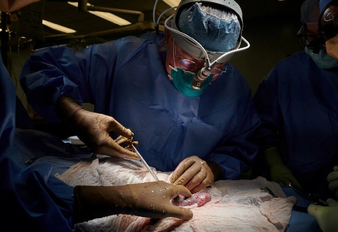 لأول مرة في التاريخ: جراحون ينجحون في زراعة كلية خنزير في جسم إنسان