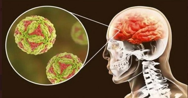 فيروس ياباني جديد يهاجم الدماغ يبدأ في الانتشار