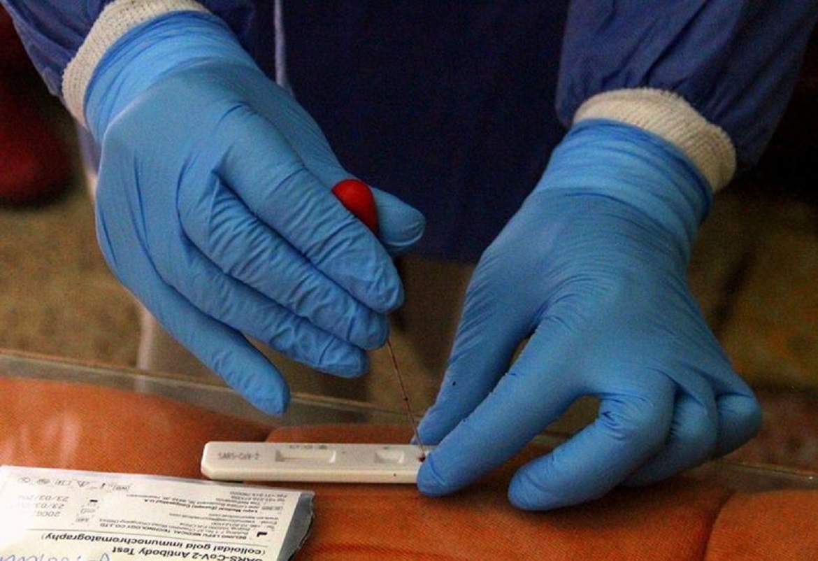 الكاف : تسجيل 15 اصابة جديدة بفيروس كورونا و73حالة شفاء