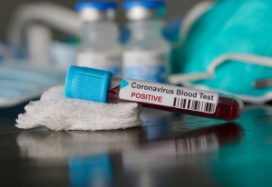 Tunisie – Coronavirus : Taux de positivité : 23,58 %, 56 nouveaux décès