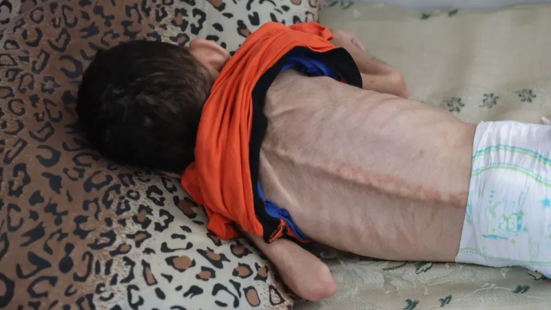 💔 طفلة تموت جوعًا في غزة: شهيدة المجاعة تفضح صمت العالم!