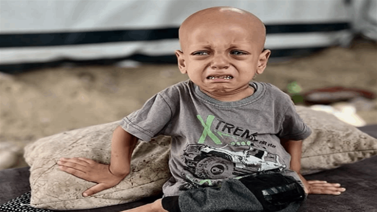غزة: وفاة الطفل عبد الله أبو زرقة (5 أعوام).. "أنا جعان" تتحوّل إلى صرخة رحيل