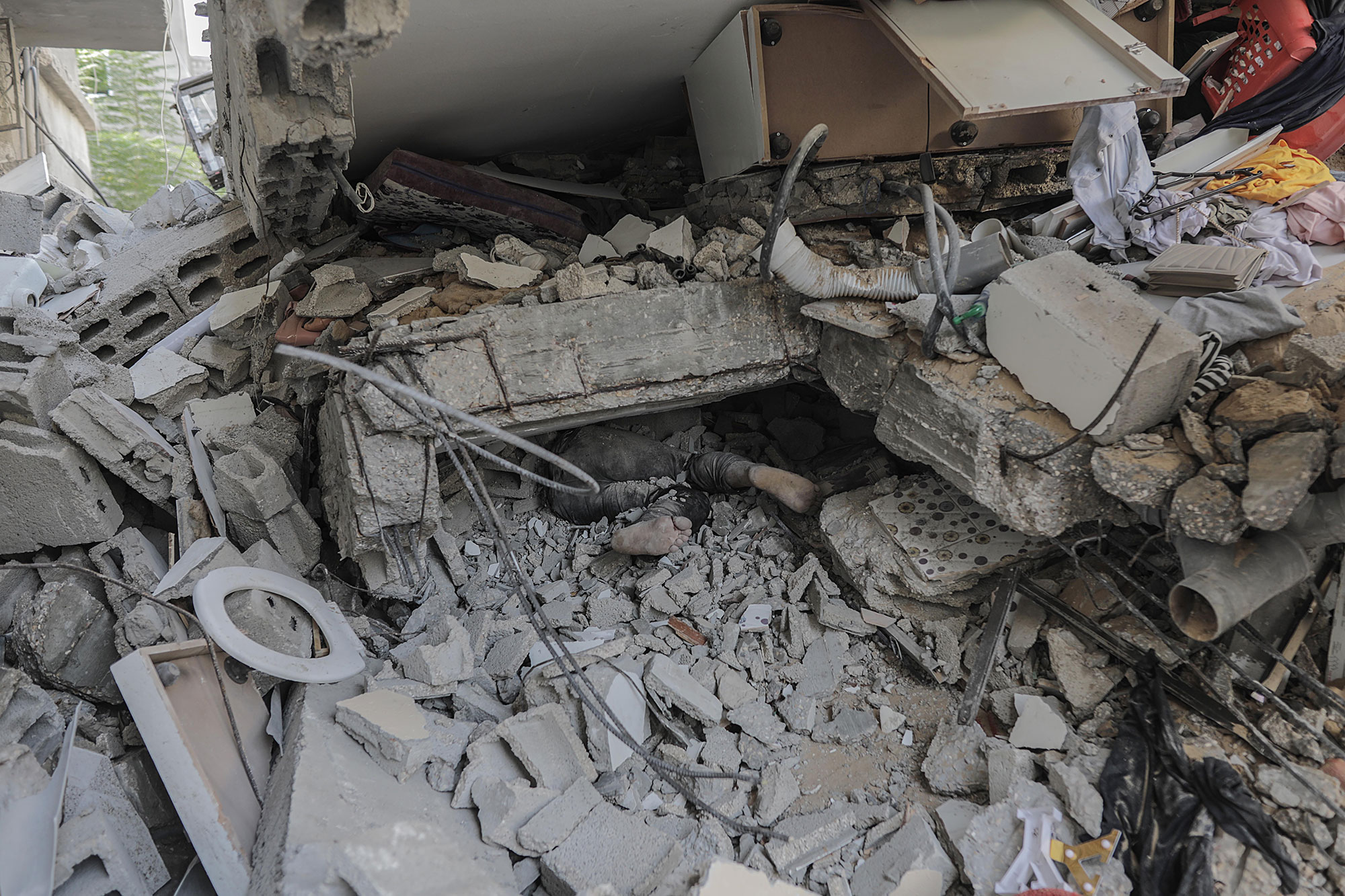 قصف إسرائيلي يستهدف المستشفيات في غزة: انتهاك خطير للقوانين الإنسانية