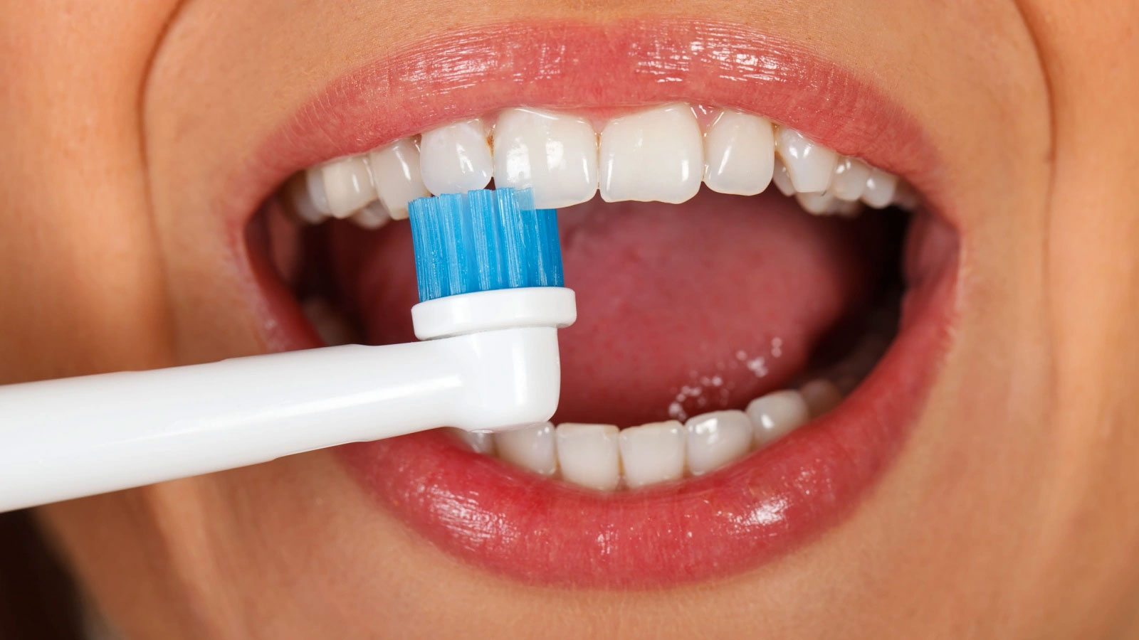 فوائد غسل الأسنان: تقليل احتمال الإصابة بالالتهاب الرئوي في المستشفى