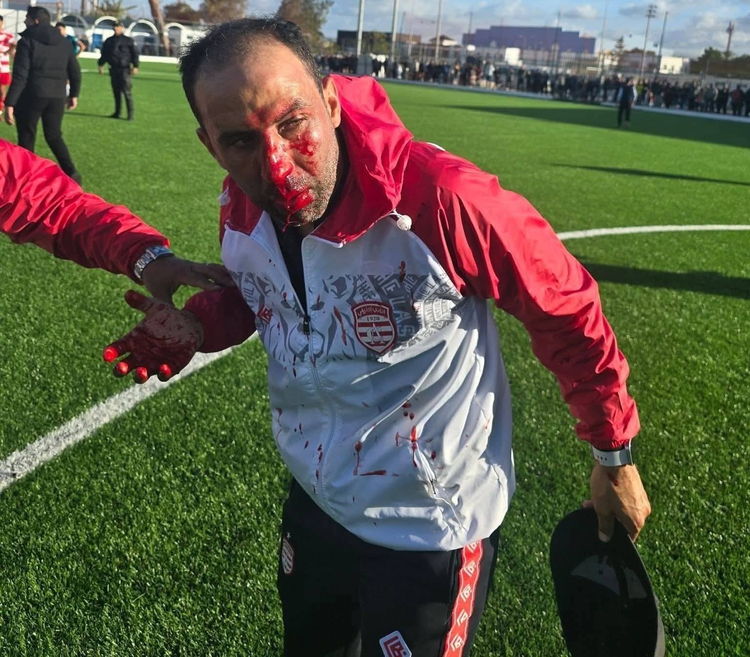 فضيحة دربي العاصمة للأواسط: اعتداءات خطيرة من لاعبي وجماهير الترجي في الحديقة “ب”... ولاعبو الإفريقي يُنقلون إلى المستشفى!