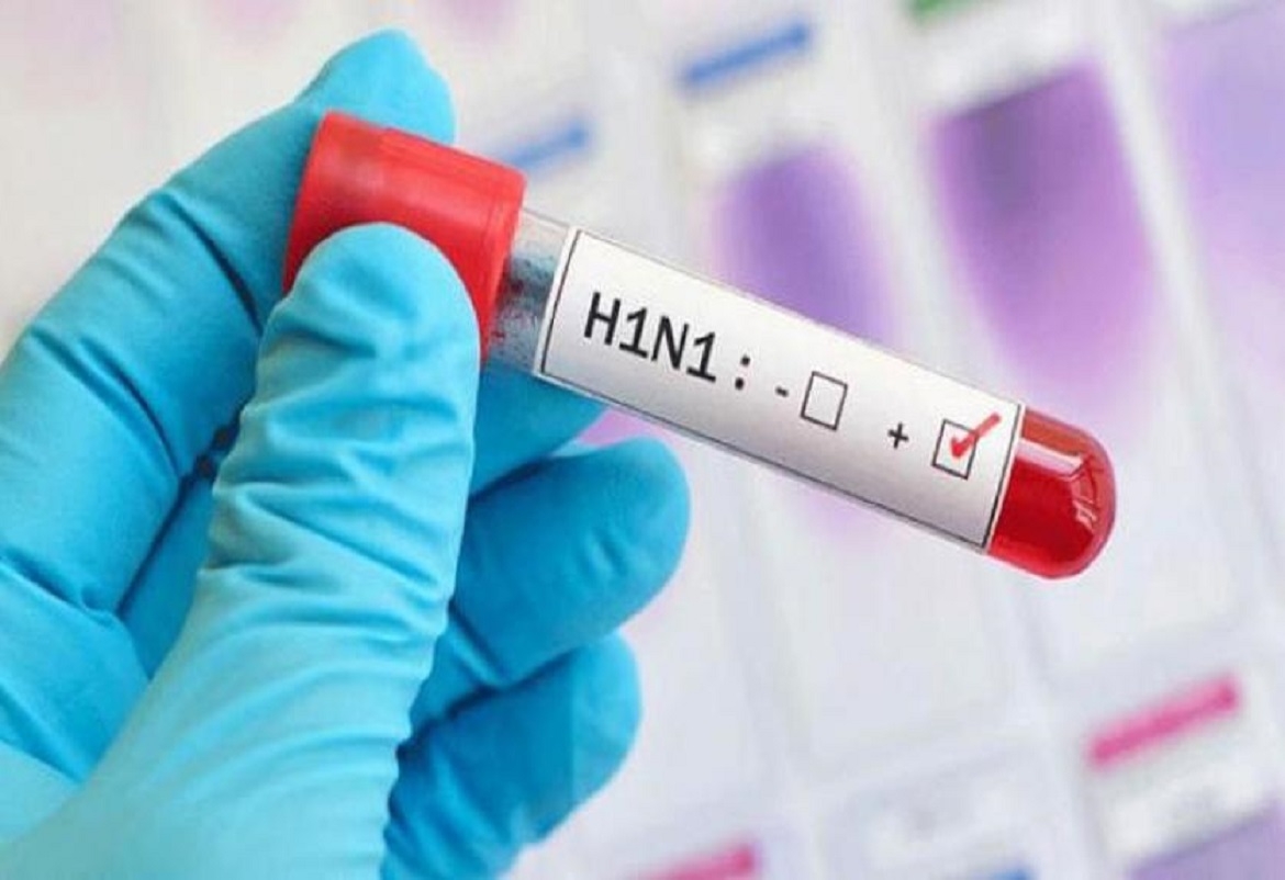 دولة عربية تكشف عن وجود إصابات بأنفلونزا الخنازير